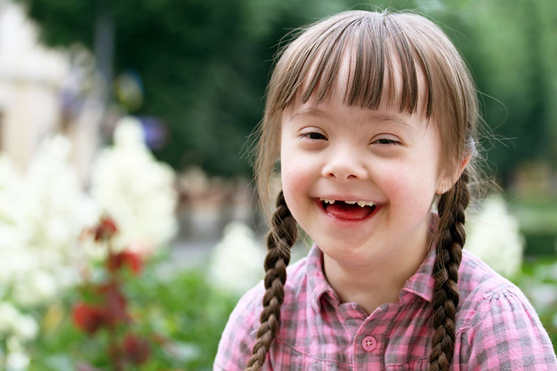 down syndrom girsml